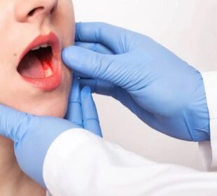 Dental Problems