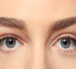 Saggy and Tired Eyelids