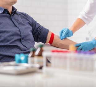 Everything You Need to Know About Myelodysplastic Syndrome Myelodysplastic Syndrome