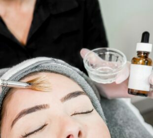 Chemical Peel