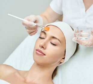 Chemical Peels