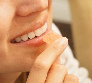 Teeth Whitening
