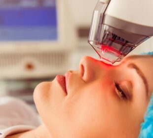 laser treatment