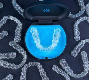 Invisalign