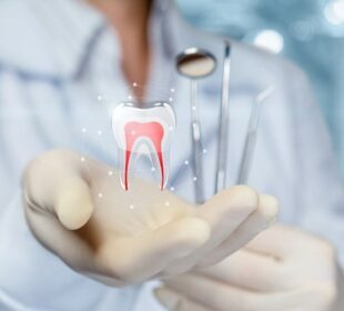 Tooth Roots