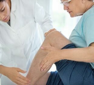 A Beginner's Guide to Cosmetic Vein Treatment Vein Treatment