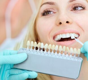 Dental Implants