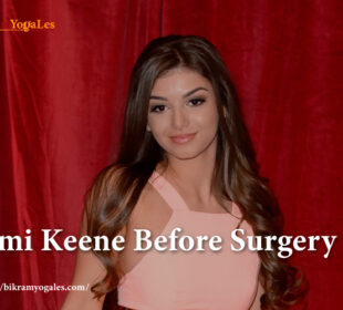 Mimi-Keene-Before-Surgery