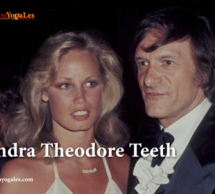 Sondra-Theodore-Teeth