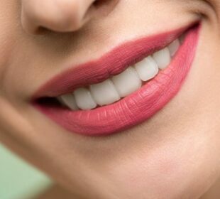 Perfect Smile