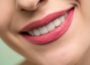 5 Types of Teeth Aligners That Can Help You Get That Perfect Smile Perfect Smile