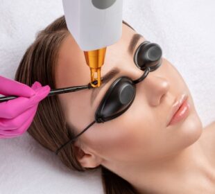 Pigmentation Removal