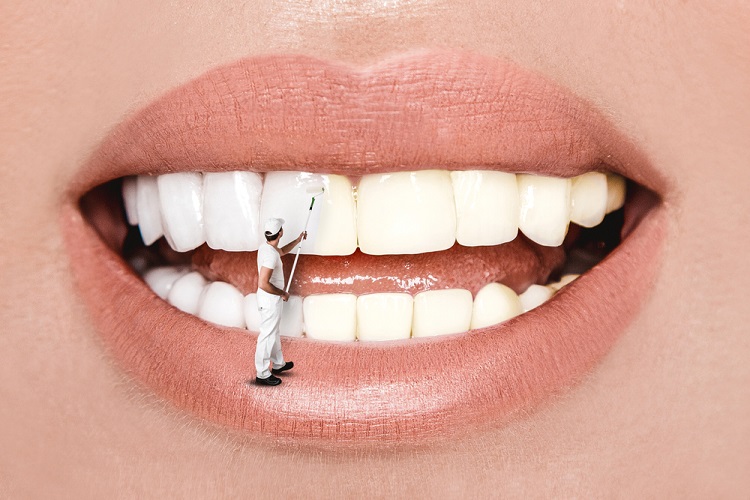 Pearl Perfect: Teeth Whitener Tips and Tricks Teeth Whitener