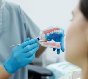 6 Things to Know Before Opting for Braces Braces